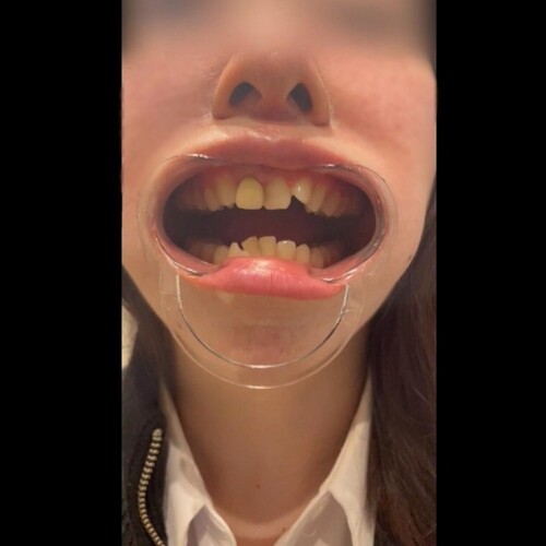 【完全素人・個人撮影】美女人妻を歯科検診余す所なく完全公開。