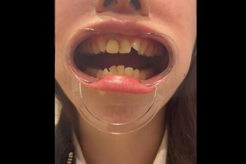 【完全素人・個人撮影】美女人妻を歯科検診余す所なく完全公開。